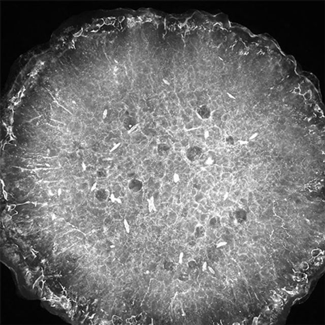 scan of protein crystal